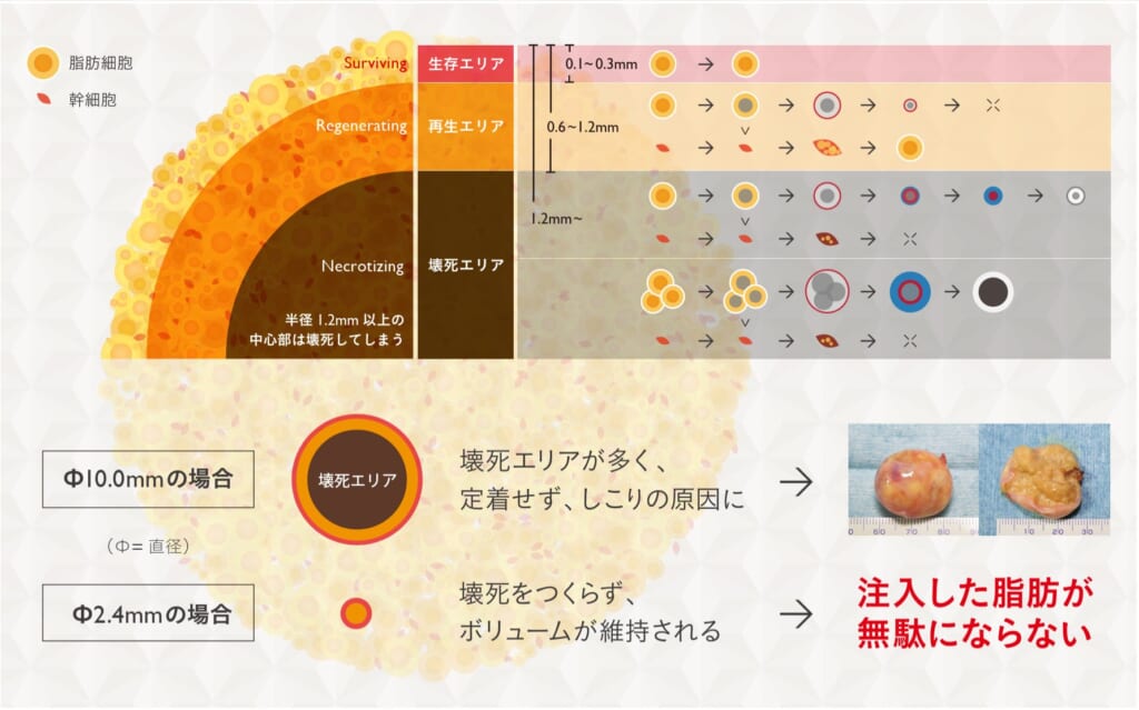 脂肪の注入サイズと定着の関係を示す図