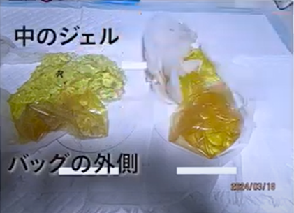 敗れたシリコンバッグ