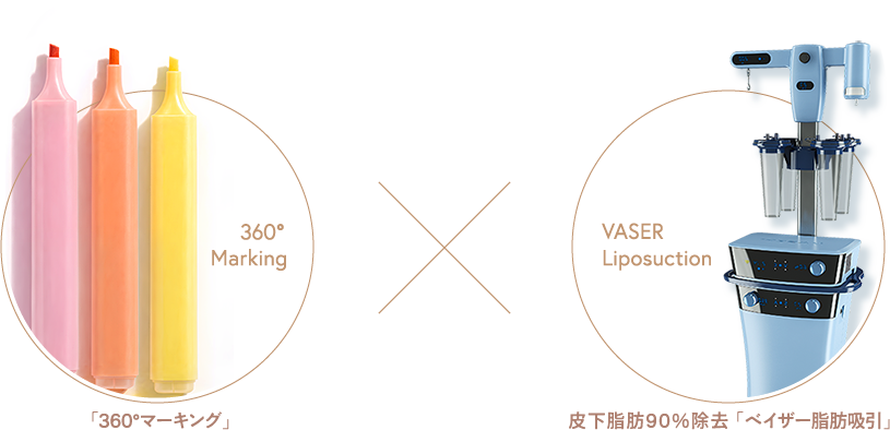 「360°マーキング」×皮下脂肪90%除去「ベイザー脂肪吸引」