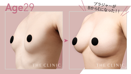Age.29 ブラジャーがBからEになった!!