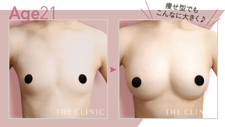 Age.21 痩せ型でもこんなに大きく♪