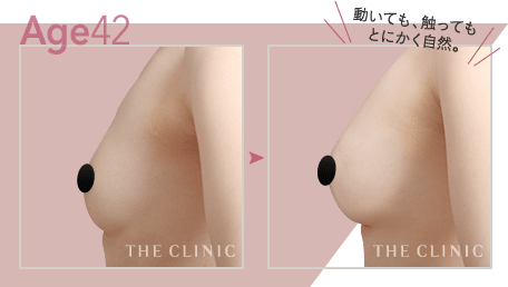 Age.42 動いても、触ってもとにかく自然。