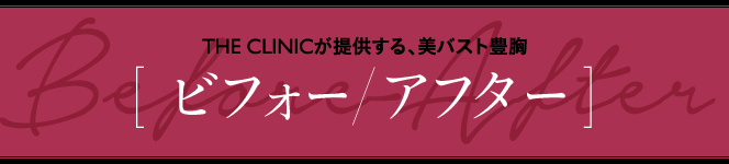 THE CLINICが提供する、美バスト豊胸 [ ビフォー/アフター ]