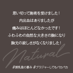 豊胸