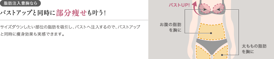 脂肪注入豊胸ならバストアップと同時に部分痩せも叶う!サイズダウンしたい部位の脂肪を吸引し、バストへ注入するので、バストアップと同時に痩身効果も実感できます。/お腹の脂肪を胸に/太ももの脂肪を胸に