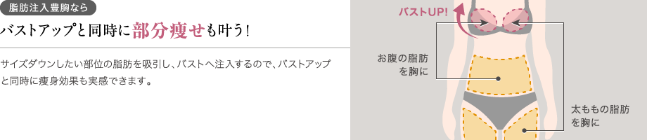 脂肪注入豊胸ならバストアップと同時に部分痩せも叶う!サイズダウンしたい部位の脂肪を吸引し、バストへ注入するので、バストアップと同時に痩身効果も実感できます。/お腹の脂肪を胸に/太ももの脂肪を胸に