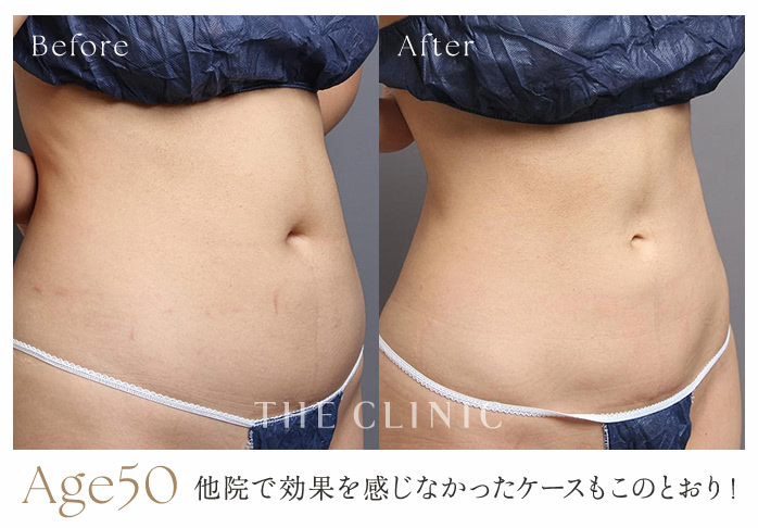 Age50 他院で効果を感じなかったケースもこのとおり！