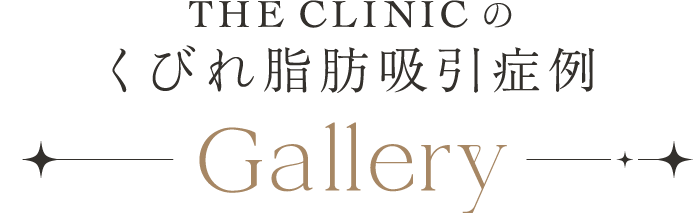 THE CLINIC のくびれ脂肪吸引症例