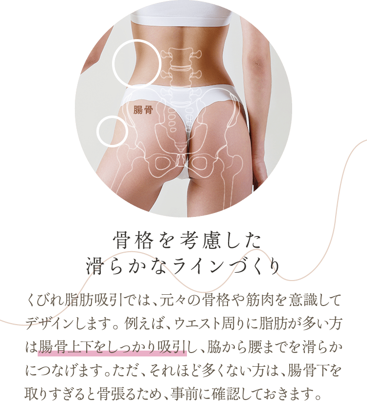 骨格を考慮した滑らかなラインづくり | くびれ脂肪吸引では、元々の骨格や筋肉を意識してデザインします。 例えば、ウエスト周りに脂肪が多い方は腸骨上下をしっかり吸引し、脇から腰までを滑らかにつなげます。ただ、それほど多くない方は、腸骨下を取りすぎると骨張るため、事前に確認しておきます。