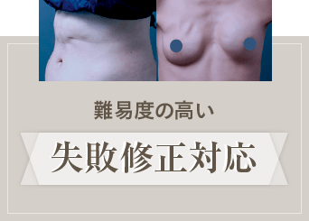 難易度の高い失敗修正対応