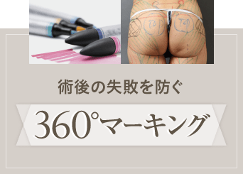 術後の失敗を防ぐ360°マーキング