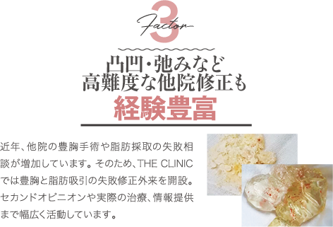 Factor 3 凸凹・弛みなど高難度な他院修正も経験豊富 | 近年、他院の豊胸手術や脂肪採取の失敗相談が増加しています。 そのため、THE CLINIC では豊胸と脂肪吸引の失敗修正外来を開設。 セカンドオピニオンや実際の治療、情報提供まで幅広く活動しています。