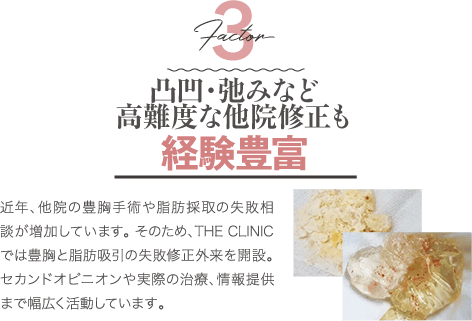 Factor 3 凸凹・弛みなど高難度な他院修正も経験豊富 | 近年、他院の豊胸手術や脂肪採取の失敗相談が増加しています。 そのため、THE CLINIC では豊胸と脂肪吸引の失敗修正外来を開設。 セカンドオピニオンや実際の治療、情報提供まで幅広く活動しています。