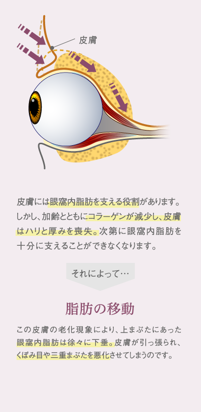 皮膚には眼窩内脂肪を支える役割があります。しかし、加齢とともにコラーゲンが減少し、皮膚はハリと厚みを喪失。次第に眼窩内脂肪を十分に支えることができなくなります。