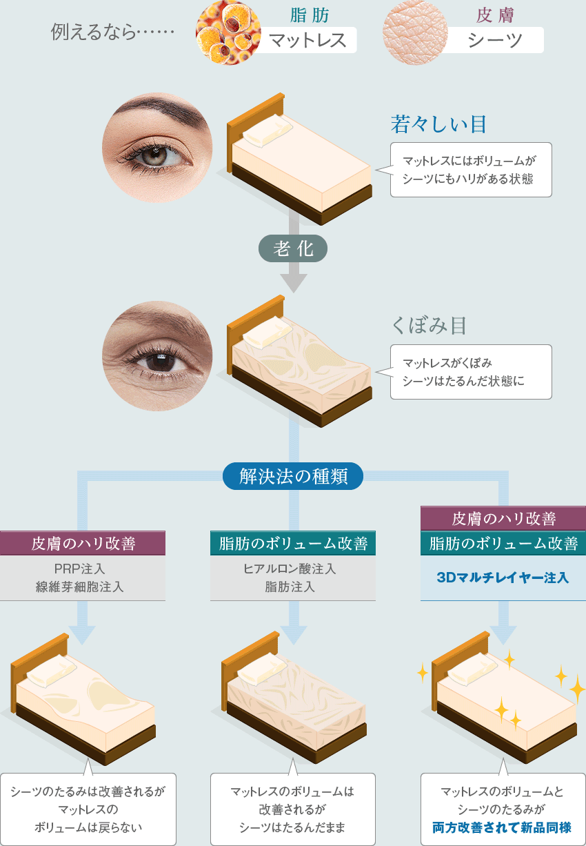 3Dマルチレイヤー注入イメージ