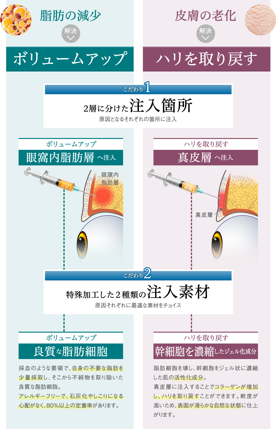 こだわり