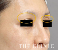 改善された症例1