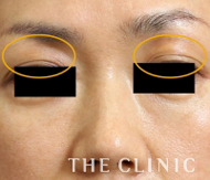 改善された症例2