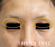 改善された症例3