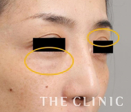 改善された症例4