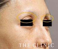 改善された症例1