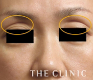 改善された症例2