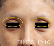 改善された症例3