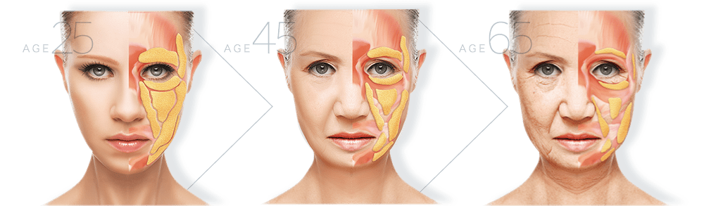 Age25 | Age45 | Age65