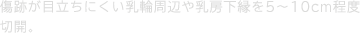 傷跡が目立ちにくい乳輪周辺や乳房下縁を5〜10cm程度切開。