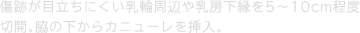 傷跡が目立ちにくい乳輪周辺や乳房下縁を5〜10cm程度切開。脇の下からカニューレを挿入。