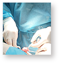 女性化乳房（男性の胸の膨らみ）の乳腺除去の様子（THE CLINIC 技術指導医 千葉明彦）