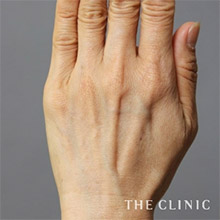 59歳／女性 before