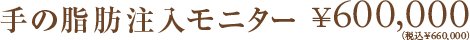 手の脂肪注入モニター ¥600,000（税込¥660,000）
