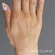 44歳／女性 before