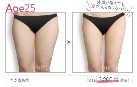 Age25 体重が増えても全然太らなくなった！