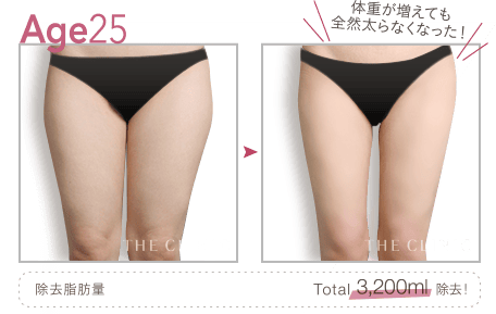 Age25 体重が増えても全然太らなくなった!