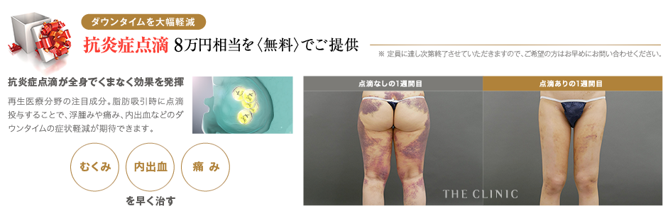 ダウンタイム大幅軽減 抗炎症点滴8万円相当を〈無料〉でご提供 ※ 定員に達し次第終了いたしますので、ご希望の方はお早めにお問い合わせください。 | 抗炎症点滴が全身でくまなく効果を発揮 再生医療分野の注目成分。脂肪吸引時に点滴投与することで、浮腫みや痛み、内出血などのダウンタイムの症状軽減が期待できます。 | むくみ / 内出血 / 痛み を早く治す