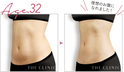 理想のお腹になれました!
