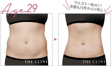 ウエスト-8cm。洋服も15号から11号に