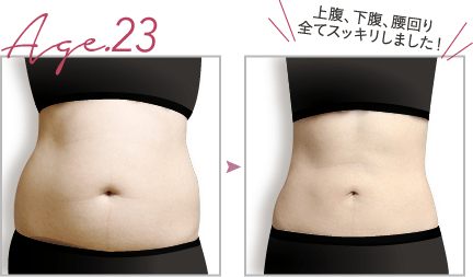 上腹、下腹、腰回り。全てスッキリしました！
