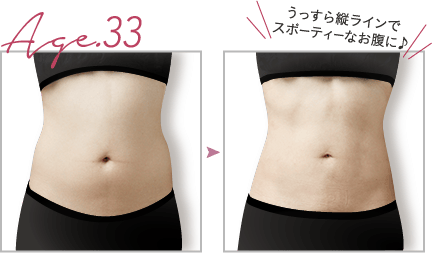 うっすら縦ラインで、スポーティなお腹に