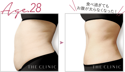 食べ過ぎてもお腹が太らなくなった！