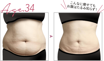 こんなに痩せても、お腹はたるみ知らず！