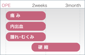 ダウンタイム症状 期間