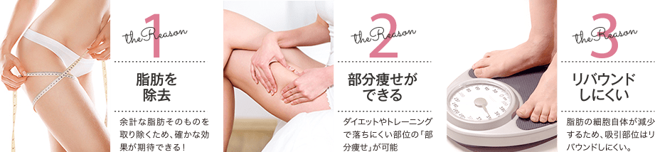 the Reason 1 脂肪を除去 / the Reason 2 部分痩せができる / the Reason 3 リバウンドしにくい 