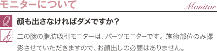 モニターについて | 顔も出さなければダメですか？ / 二の腕の脂肪吸引モニターは、パーツモニターです。 施術部位のみ撮影させていただきますので、お顔出しの必要はありません。
