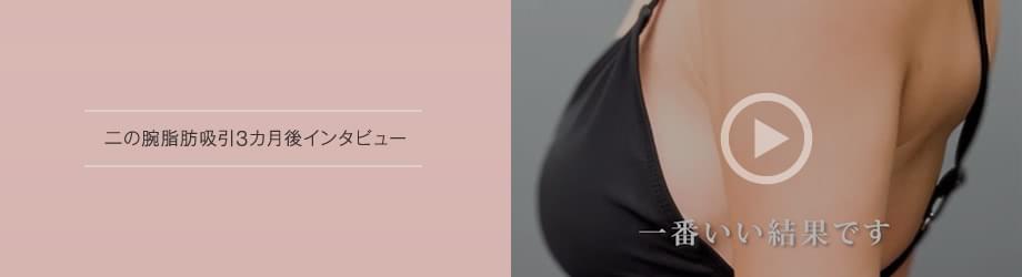 お腹脂肪吸引2カ月後インタビュー