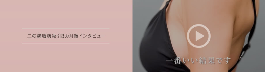 お腹脂肪吸引2カ月後インタビュー