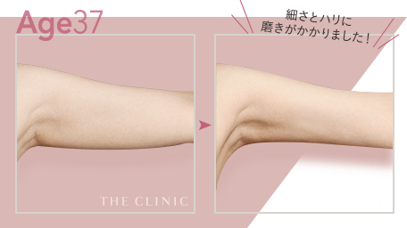 Age37 細さとハリに磨きがかかりました！