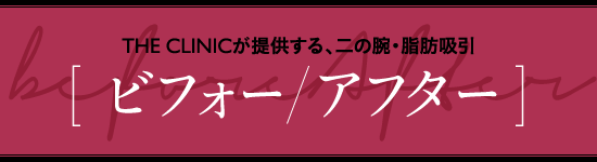 THE CLINICが提供する、二の腕・脂肪吸引 [ ビフォー/アフター ]